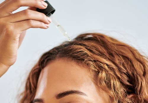 Say Goodbye to Dandruff with These Beauty Hacks